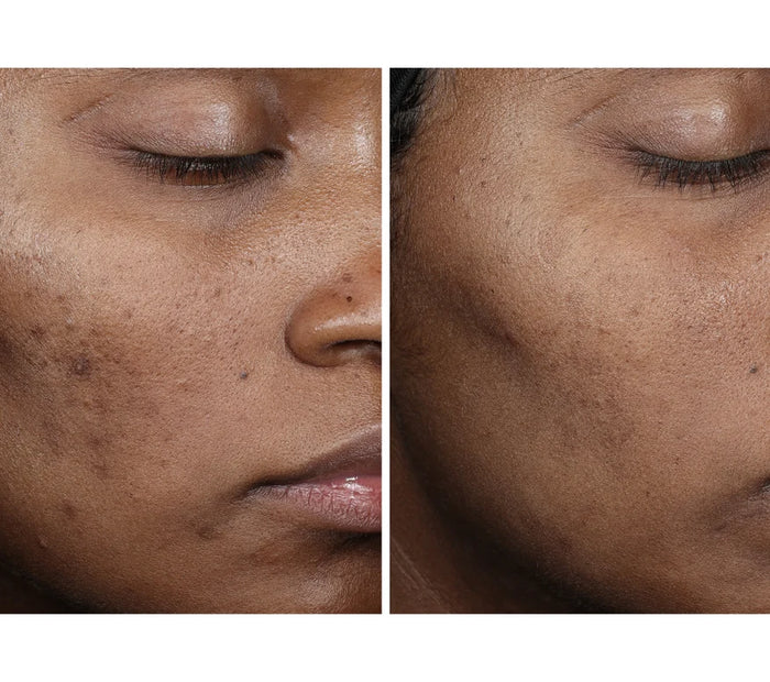 Complexion Brightening Serum